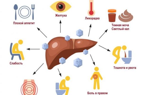 Ситуация по заболеваемости вирусным гепатитом А в Могилевской области оценивается как стабильная и контролируемая — санэпидслужба